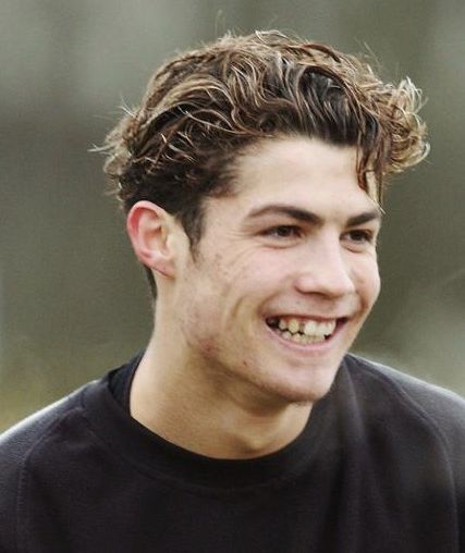 ronaldo avant chirurgie
