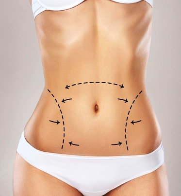 Abdominoplastie tunisie