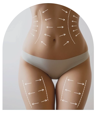 chirurgie silhouette tunisie