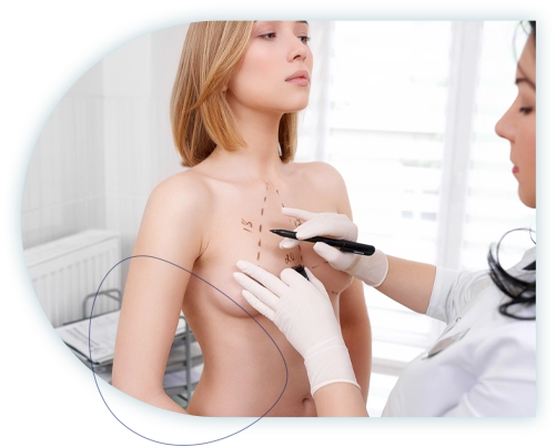 les Indications au lipofilling mammaire