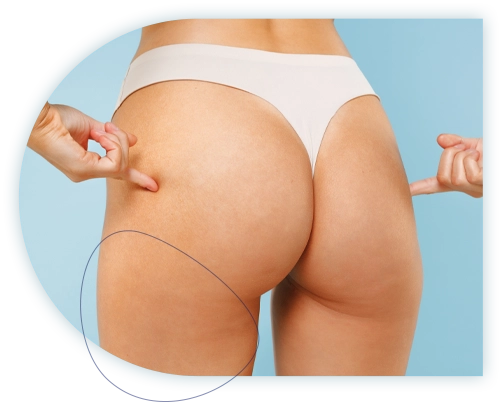 Liposuccion turquie Déroulement
