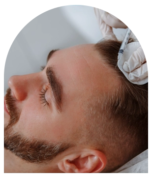 PRP cheveux Tunisie