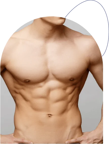 Les suites opératoires d'une gynecomastie